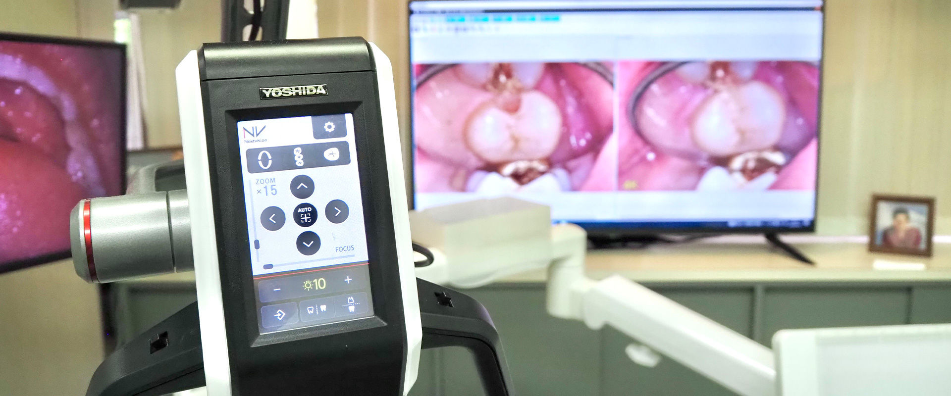 スライドショー